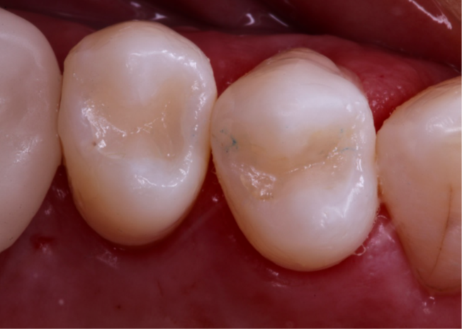 20- Imagem final do caso clínico