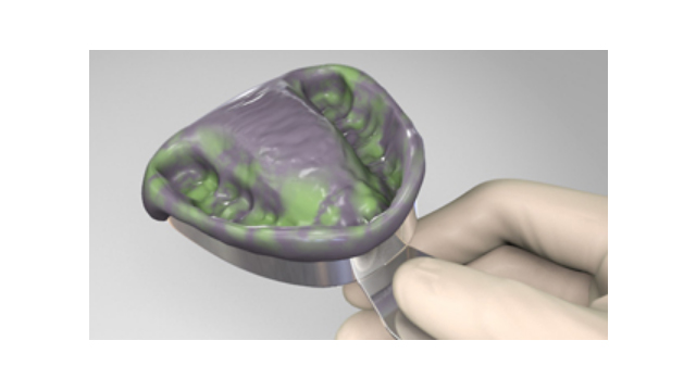 Materiais de Moldagem de Precisão - Silicone por adição (VPS)