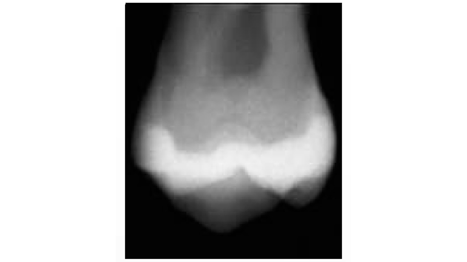 Charisma® Classic permite fazer diagnósticos seguros e confiáveis. 