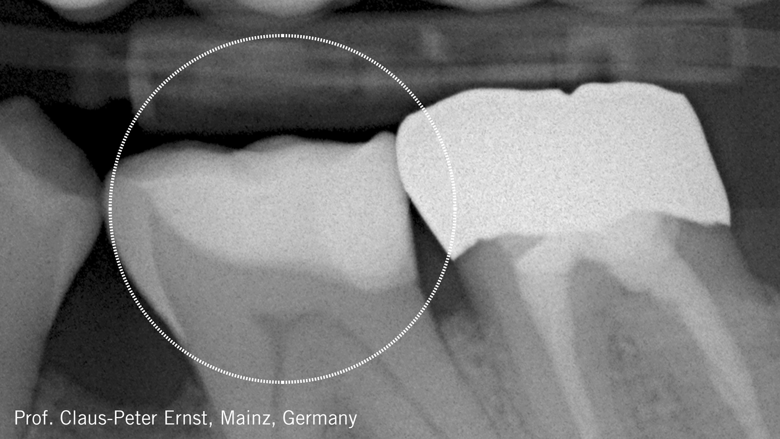 Charisma Diamond ONE