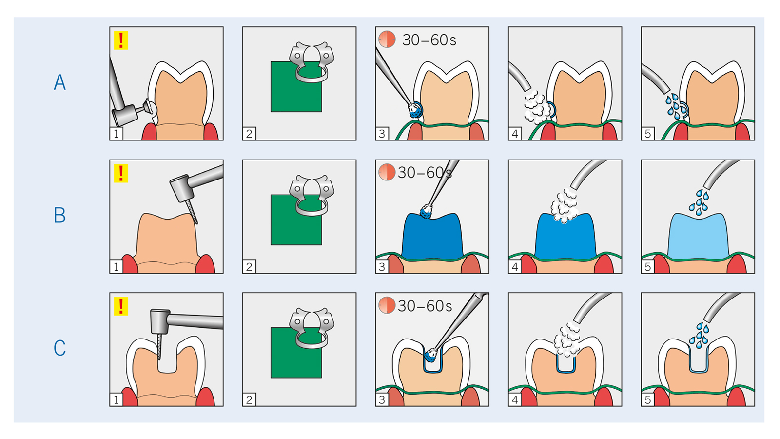 Application guide GLUMA Desensitizer 