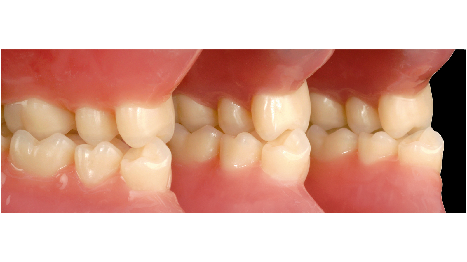  Montagem multifuncional com Pala Premium 8